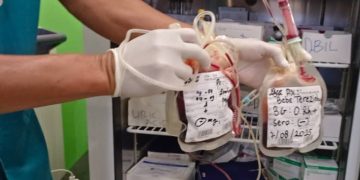 Ospital Referal Maubise Empresta Makina Raio-X Husi Iom Hodi Konsulta Pasientes